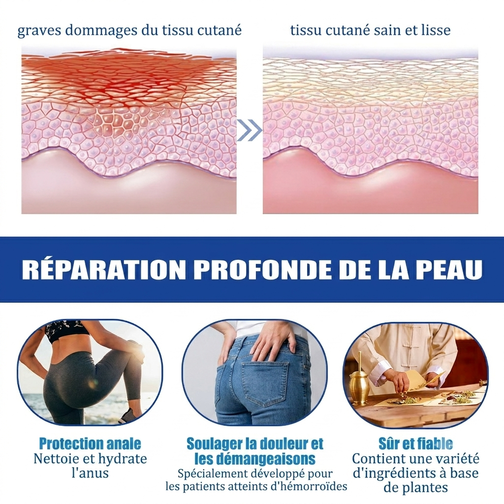 Gélules de Plantes Naturelles – Soin Hémorroïdes & Constipation