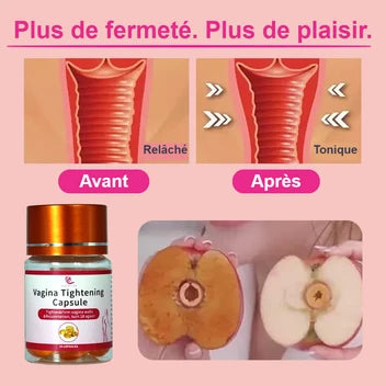 Capsules Intimes SereneCare – Boîte de 10